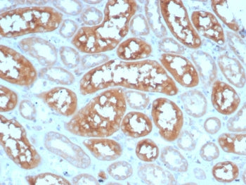IHC staining of FFPE human kidney tissue with Adenylyl cyclase 8 antibody (clone ADCY8/7574). HIER: