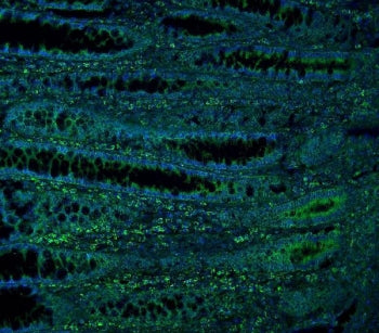 ME2 Antibody / NAD-ME