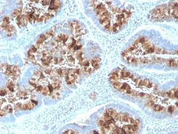 MUC1 Antibody / Mucin-1