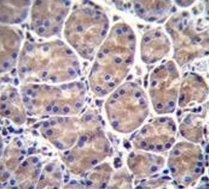GALNS Antibody