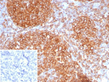 HLA-DR Antibody (MHC II)