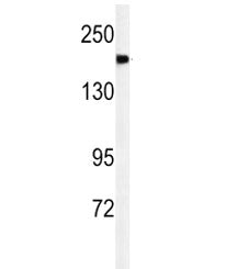 Alpha-2-macroglobulin-like protein 1 Antibody / A2ML1