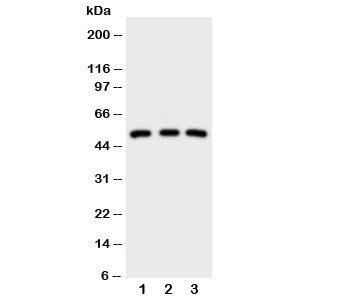 IRAK4 Antibody