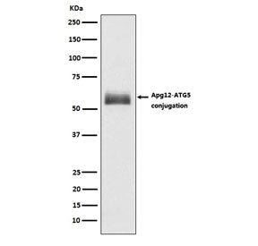 Western blot testing of human HepG2 lysate with ATG12 antibody. Expected molecular weight: ~15 kDa (