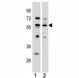 KLF4 antibody western blot analysis in (1) MCF-7 (2) K562 lysate. Predicted molecular weight: 50-60