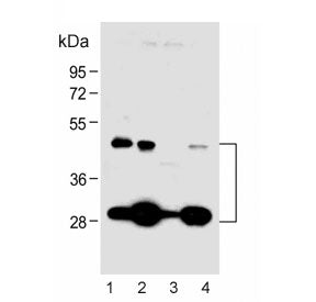 CTSD Antibody / Cathepsin D