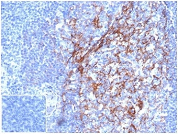 IHC staining of FFPE human tonsil tissue with CD23 antibody (clone FCER2/6887) at 2ug/ml in PBS for