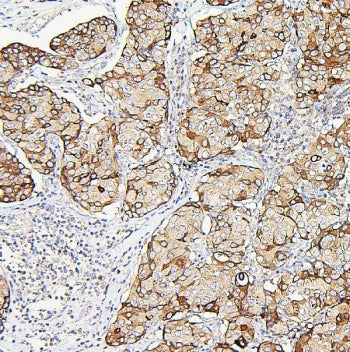 Aldolase A Antibody / ALDOA