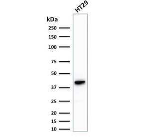 Cytokeratin 20 Antibody / CK20