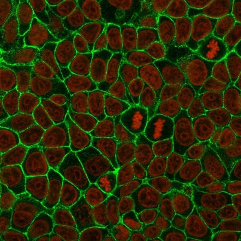 E-Cadherin Antibody / CDH1
