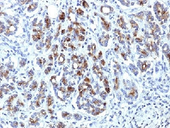Alpha-1-Antichymotrypsin Antibody / AACT / SERPINA3