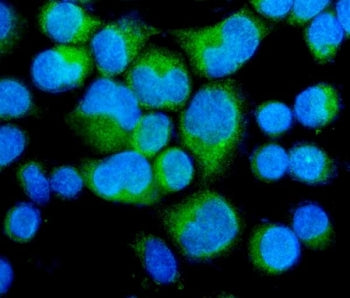 Myosin Phosphatase Antibody