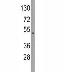 Integrin linked kinase Antibody (ILK)