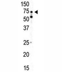AMPK alpha 2 Antibody / PRKAA2, 0.4ml