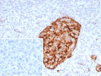 GAD65 Antibody / GAD2