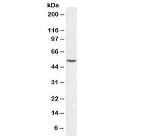 Alanine aminotransferase 1 Antibody