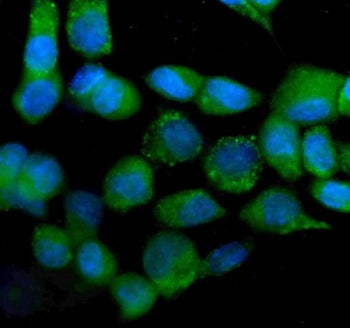 IDH2 Antibody / Isocitrate dehydrogenase 2