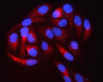PIGS Antibody / Phosphatidylinositol glycan class S