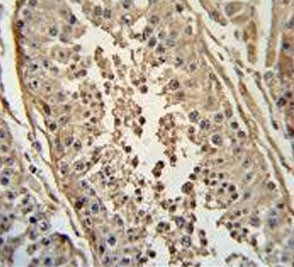 FBX24 Antibody / FBXO24