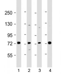 SKI Antibody