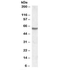 Western blot testing of human skeletal muscle lysate with IMPDH2 antibody at 1ug/ml. Predicted molec