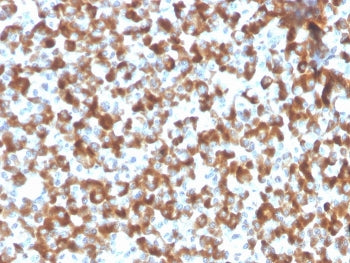 FSH beta Antibody