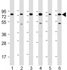 PABPC3 Antibody / Polyadenylate-binding protein 3