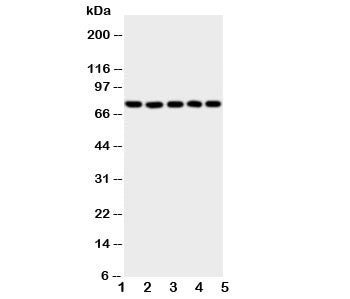 5-Lipoxygenase Antibody