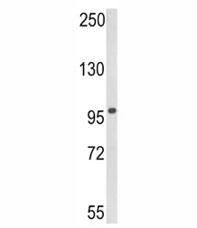 DDX58 Antibody