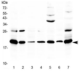 Western blot testing of 1) rat thymus, 2) rat lung, 3) rat spleen, 4) rat stomach, 5) rat PC-12 cell