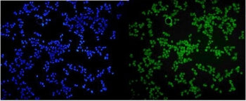 MCPIP1 Antibody / ZC3H12A