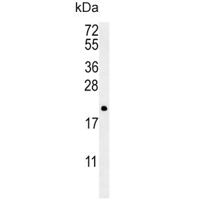 PTP4A2 Antibody