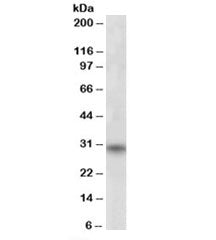 Western blot testing of human skeletal muscle lysate with FHL3 antibody at 1ug/ml. Predicted molecul
