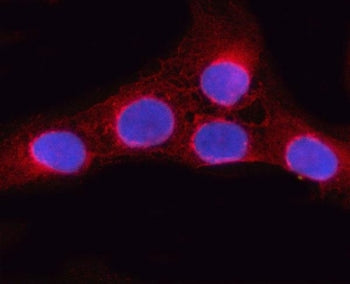 ORP9 Antibody / OSBPL9