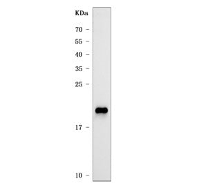 Western blot testing of human A431 cell lysate with CLDN1 antibody. Expected molecular weight: 20-23