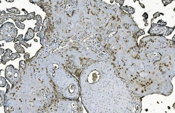 DNAJC10 Antibody
