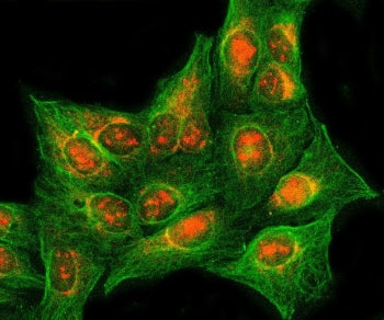 RASSF2 Antibody / Ras association domain-containing protein 2