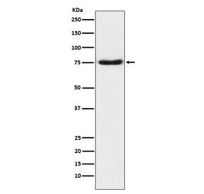 Netrin 1 Antibody / NTN1