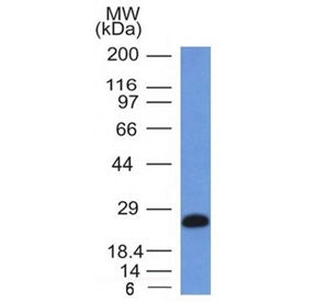Western blot testing of human Ramos cell lysate with CD79a antibody (clone IGA/1406). Expected molec