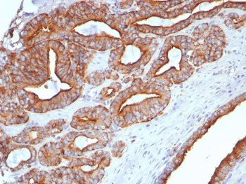 LAMP1 Antibody / CD107A