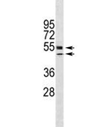 VDR Antibody