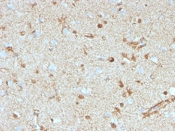 S100B Antibody