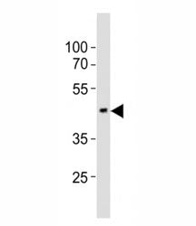 Western blot testing of EED antibody at 1:1000 dilution + mouse brain lysate; Predicted molecular we