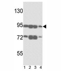 ABCB5 Antibody
