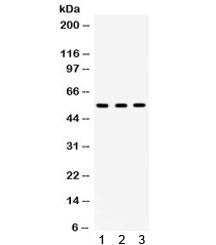 Western blot testing of 1) rat lung, 2) mouse liver and 3) human HeLa lysate with Integrin linked ki