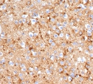 Synaptophysin Antibody