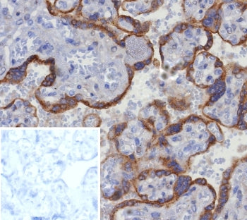 Glypican 3 Antibody / GPC3