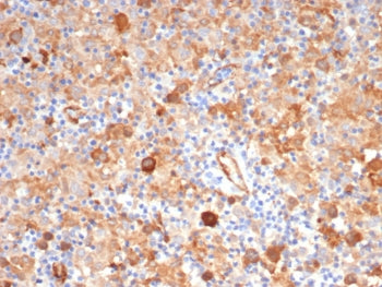 Fascin 1 Antibody