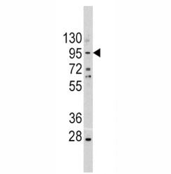 Western blot analysis of anti-E Cadherin antibody and A375 lysate. Expected molecular weight: 135 kDa (precursor), 80-120 kDa (mature, depending on gylcosylation level).