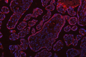 Immunofluorescent staining of FFPE human placental tissue with SSR3 antibody (red) and DAPI nuclear